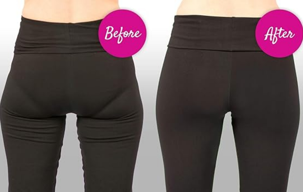 before-after-shapewear