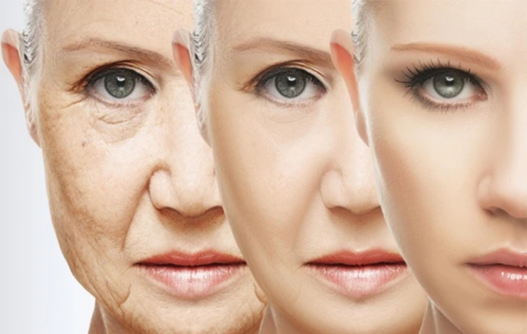 wrinkle-from-old-to-young